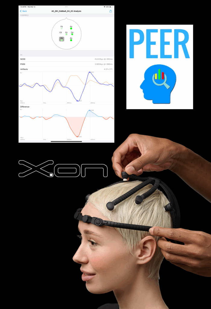 PEER App Mobile EEG