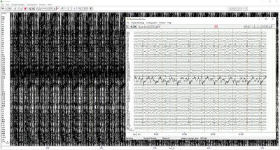 BrainVision RecView